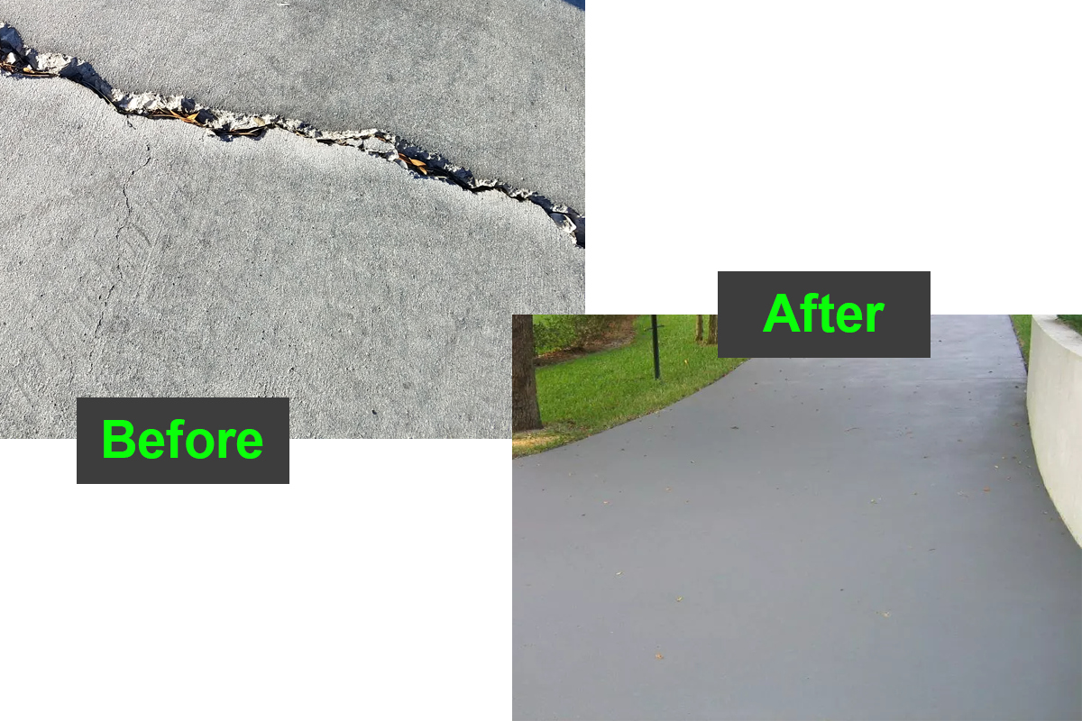 5Diamond Before and After